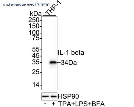 HUABIO ET1701-39 image 1