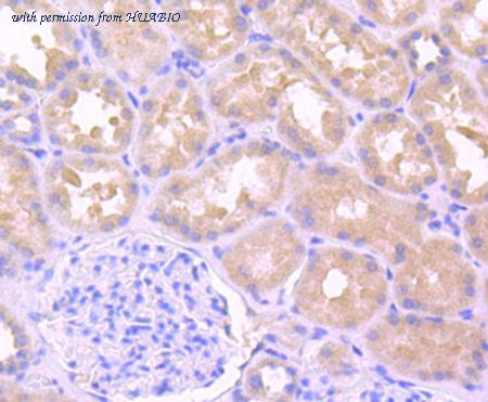 HUABIO ET1701-39 image 3