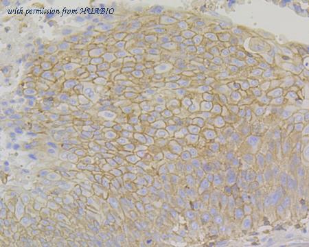 HUABIO ET1701-41-50UL image 2