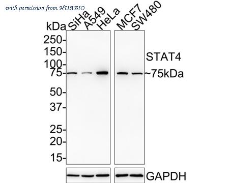 HUABIO ET1701-42 image 1