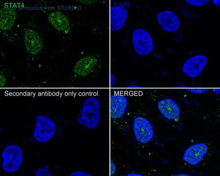 HUABIO ET1701-42 image 2