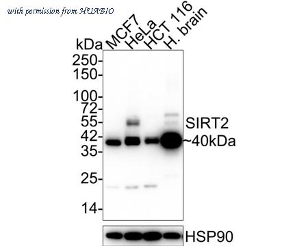 HUABIO ET1701-43 image 1