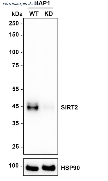 HUABIO ET1701-43 image 2