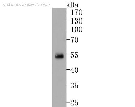 HUABIO ET1701-44 image 1