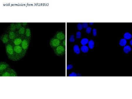 HUABIO ET1701-44 image 2