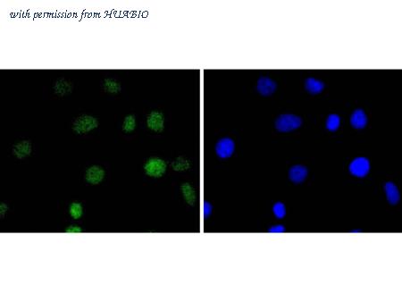 HUABIO ET1701-44 image 3