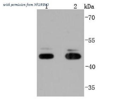 HUABIO ET1701-47 image 1