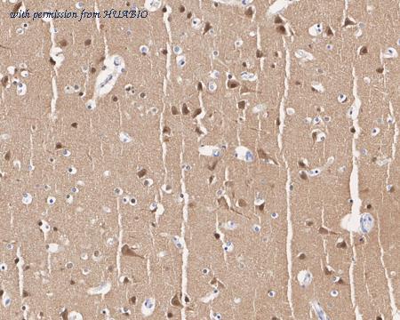 HUABIO ET1701-47 image 2