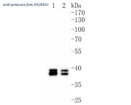 HUABIO ET1701-48 image 1