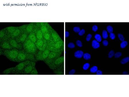 HUABIO ET1701-48 image 3