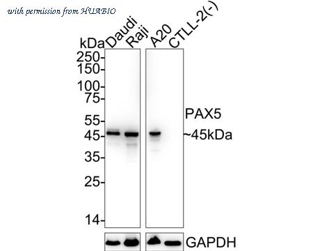 HUABIO ET1701-49 image 1