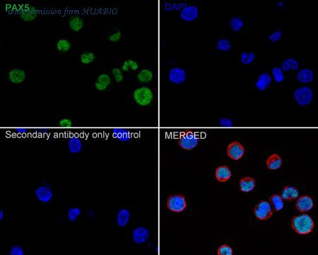 HUABIO ET1701-49 image 2