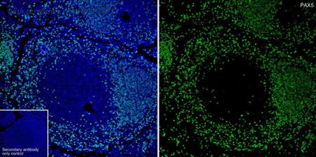 HUABIO ET1701-49 image 3