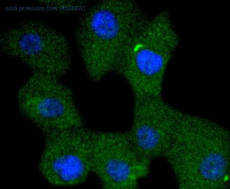 HUABIO ET1701-5 image 1