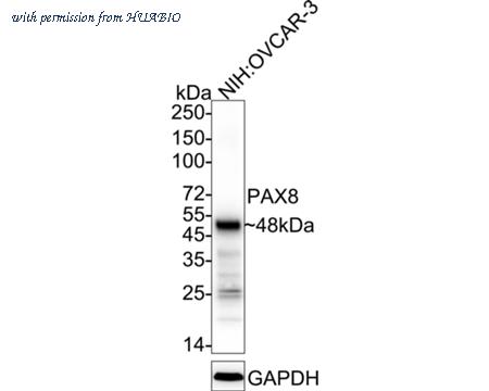 HUABIO ET1701-50 image 2