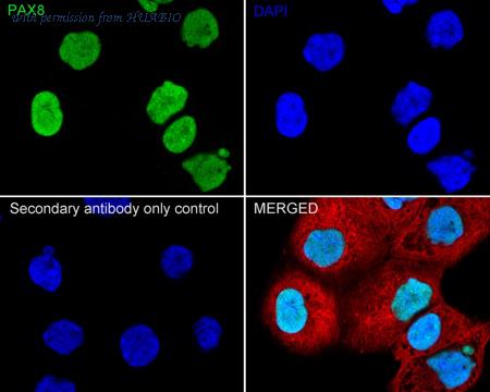 HUABIO ET1701-50 image 3