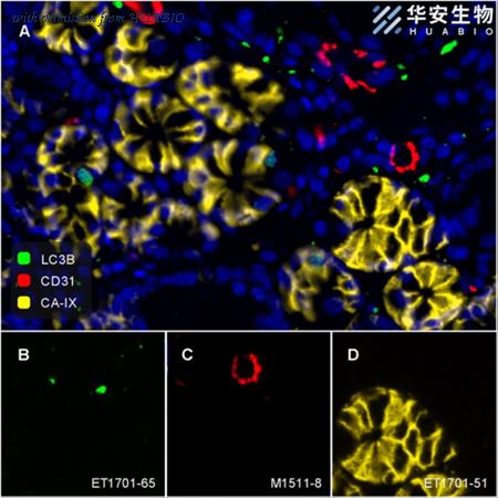 HUABIO ET1701-51 image 1
