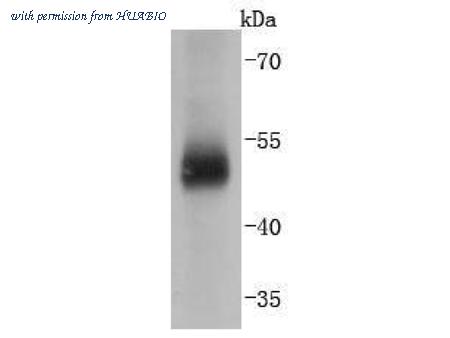 HUABIO ET1701-51 image 2
