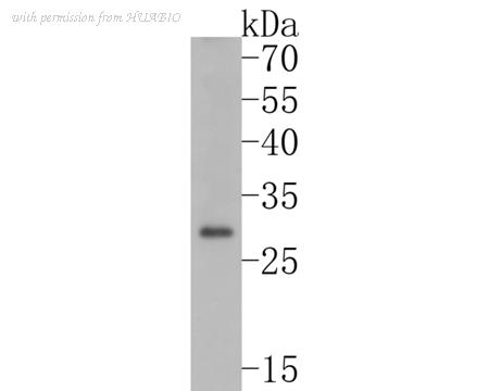 HUABIO ET1701-52 image 1