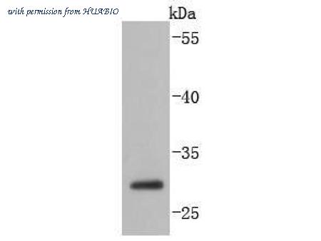 HUABIO ET1701-52 image 2