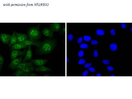 HUABIO ET1701-52 image 3