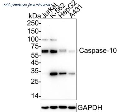 HUABIO ET1701-53 image 1