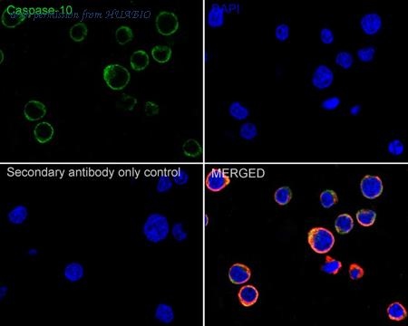 HUABIO ET1701-53 image 2
