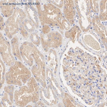 HUABIO ET1701-53 image 3