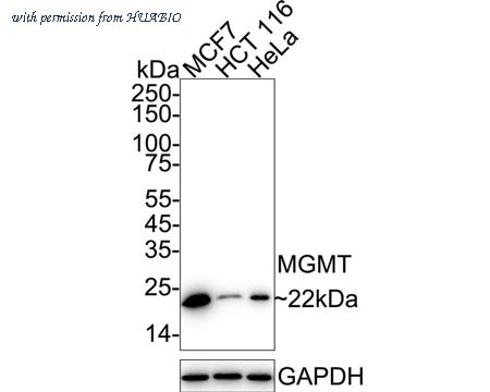 HUABIO ET1701-55 image 2
