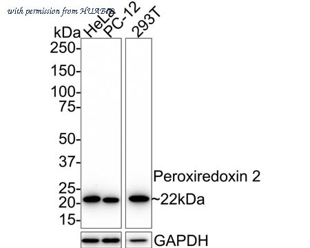 HUABIO ET1701-61 image 1