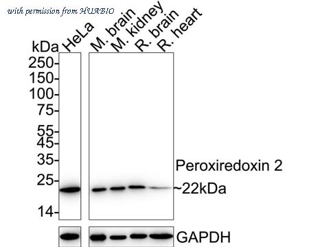 HUABIO ET1701-61 image 2