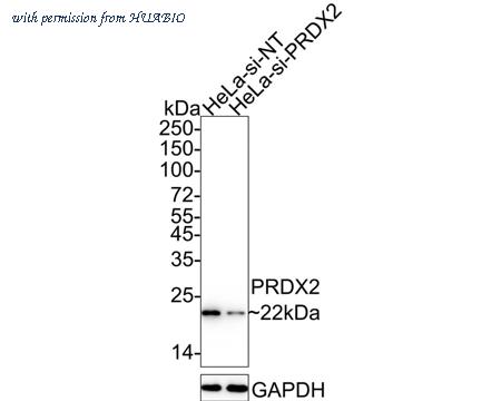 HUABIO ET1701-61 image 3