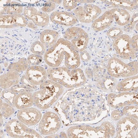 HUABIO ET1701-66 image 3