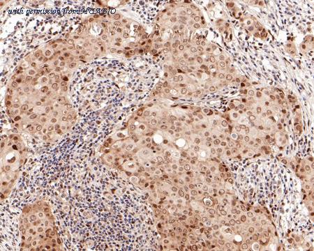 HUABIO ET1701-69 image 2