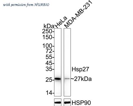 HUABIO ET1701-70 image 1