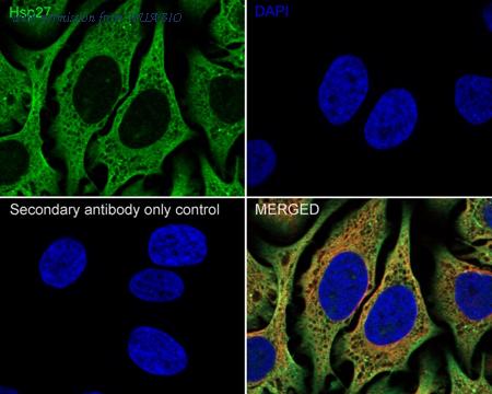 HUABIO ET1701-70 image 3