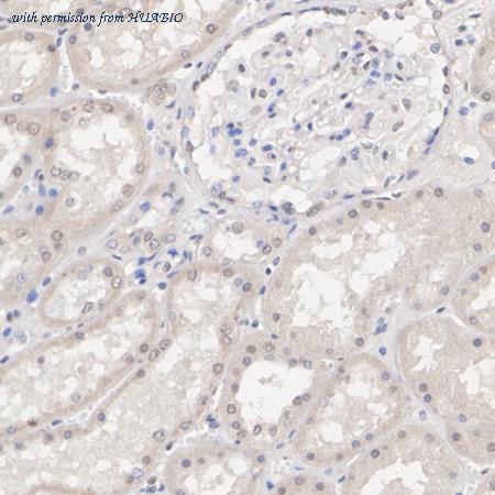 HUABIO ET1701-71 image 1