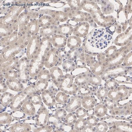 HUABIO ET1701-71 image 2