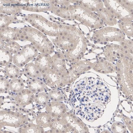 HUABIO ET1701-71 image 3