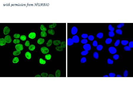 HUABIO ET1701-73 image 3