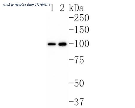 HUABIO ET1701-75 image 1