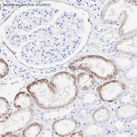 HUABIO ET1701-77 image 1