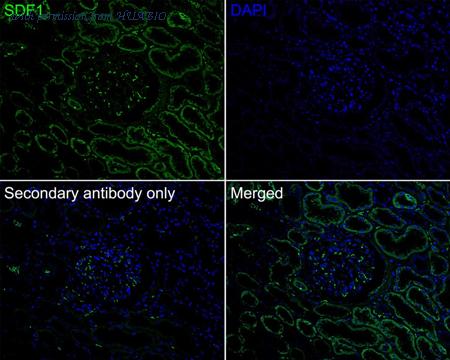 HUABIO ET1701-77 image 2
