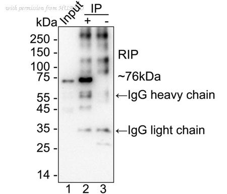 HUABIO ET1701-79 image 3