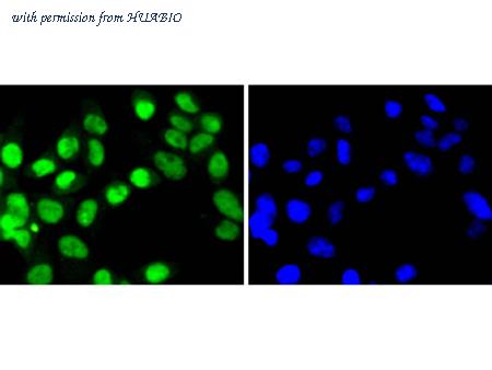 HUABIO ET1701-8 image 2