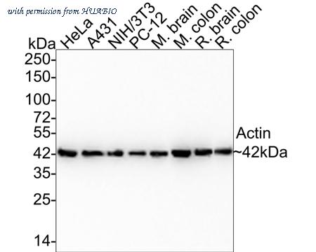 HUABIO ET1701-80-50UL image 1