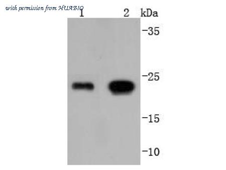 HUABIO ET1701-84 image 1