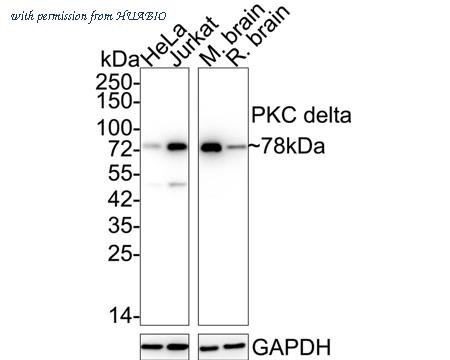 HUABIO ET1701-85 image 1