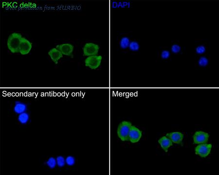 HUABIO ET1701-85 image 2