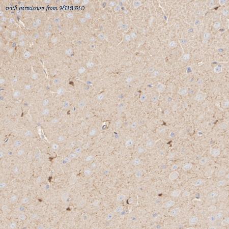 HUABIO ET1701-85 image 3